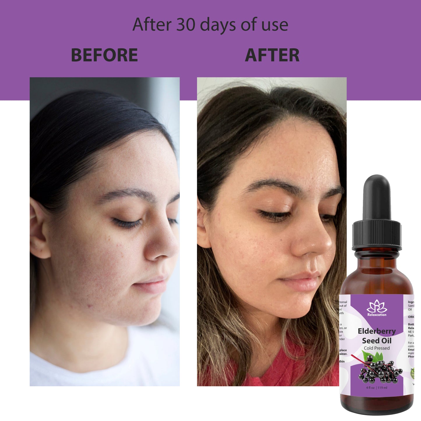 Pure Elderberry Seed Oil