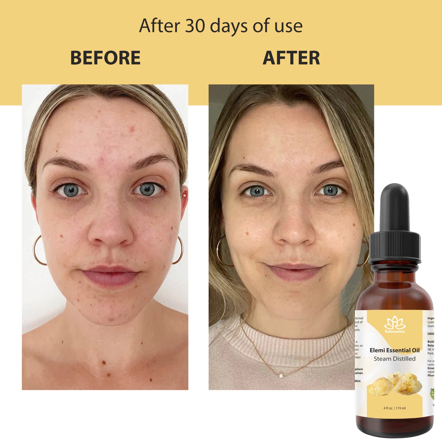 Pure Elemi Essential Oil