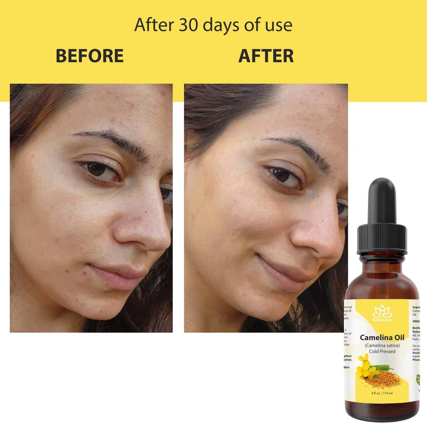 Vitamin E Oil – Ultra Moisture & Defense