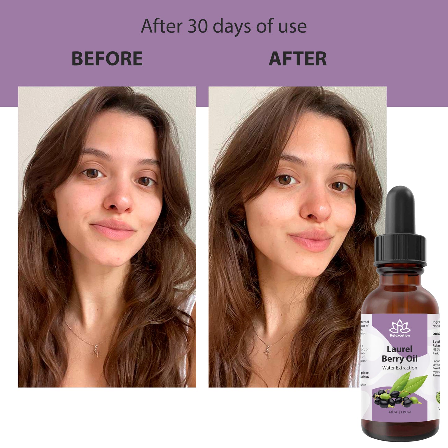 Pure Laurel Berry Oil