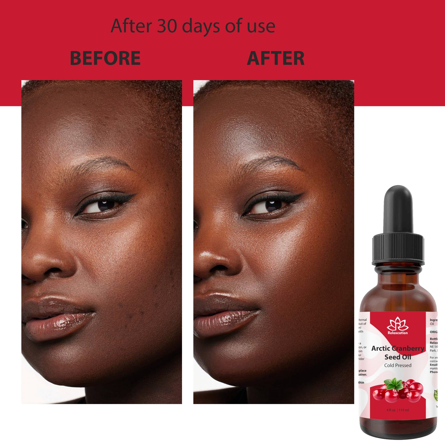 Arctic Cranberry Seed Oil Cold Pressed | Pure Vaccinium Macrocarpon Oil | Natural Facial Oil | Hair And Skin Carrier Oil Choose 0.5–4 oz