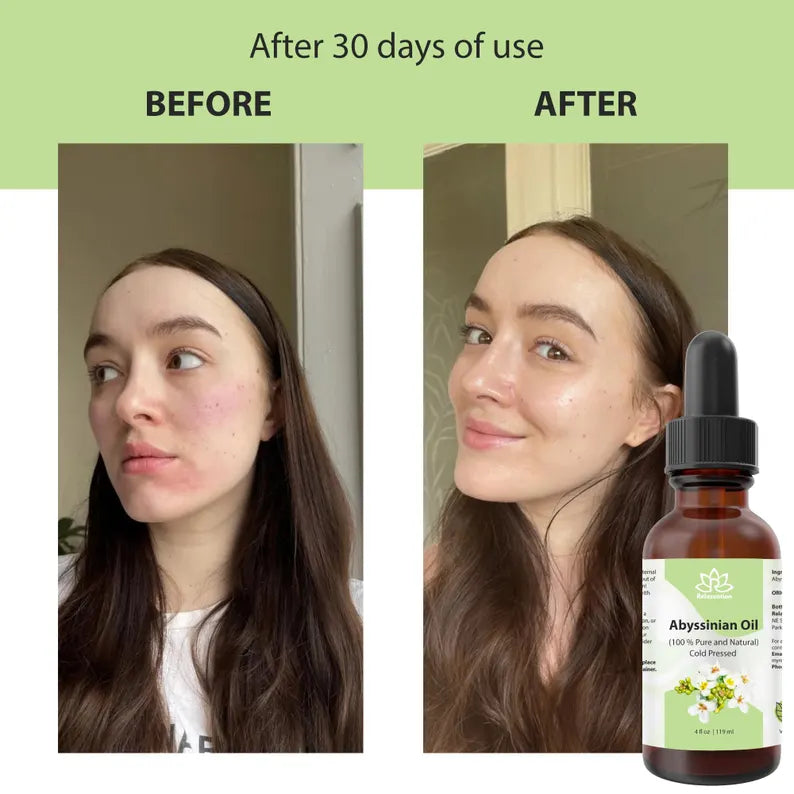 Abyssinian (crambe) seed Oil