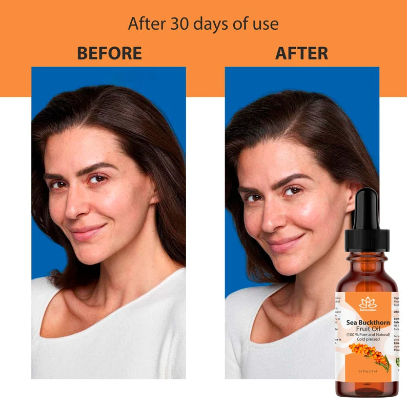 Organic Sea Buckthorn Essential Oil