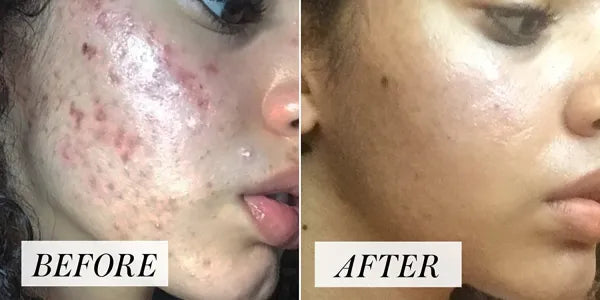 Pure Indian Healing Bentonite Clay