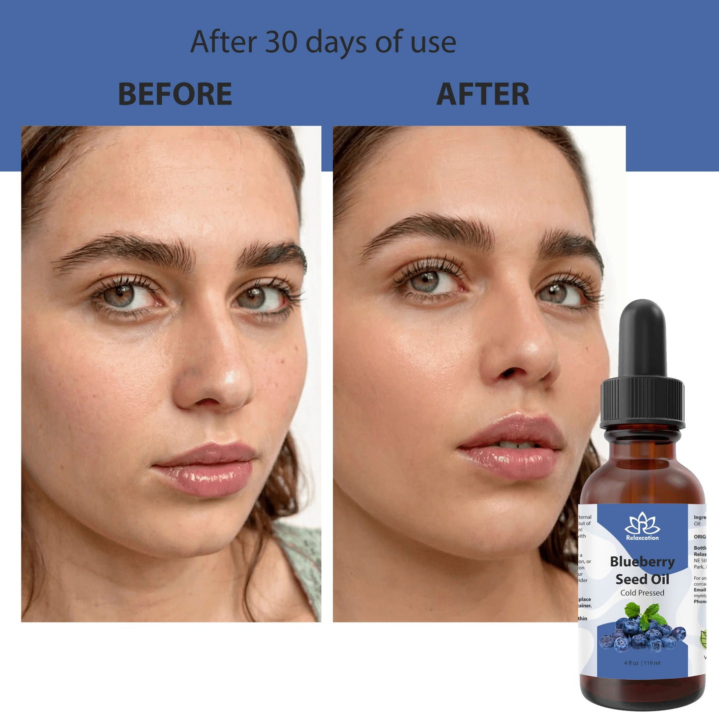 Pure Blueberry Seed Oil Cold Pressed – 100% Botanical Plant Oil | Natural Antioxidant Facial Oil