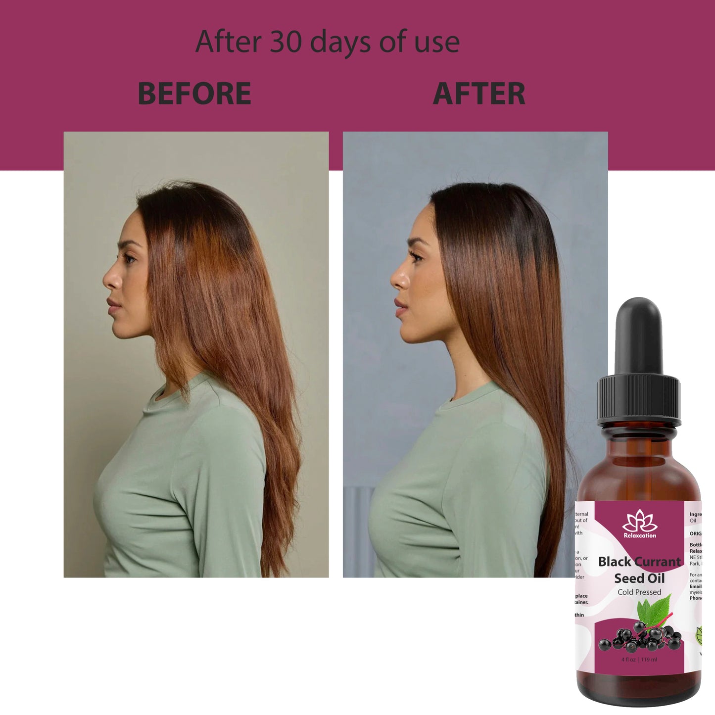 Pure Blackcurrant Seed Oil – 100% Botanical Cold-Pressed Oil for Skin & Hair